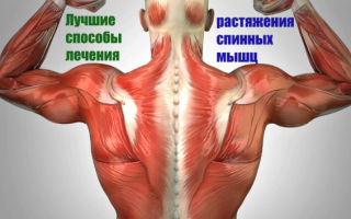 Лучшие способы лечения растяжения спинных мышц